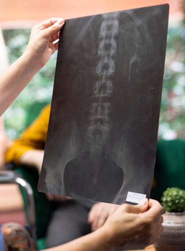 Catastrophic Injuries